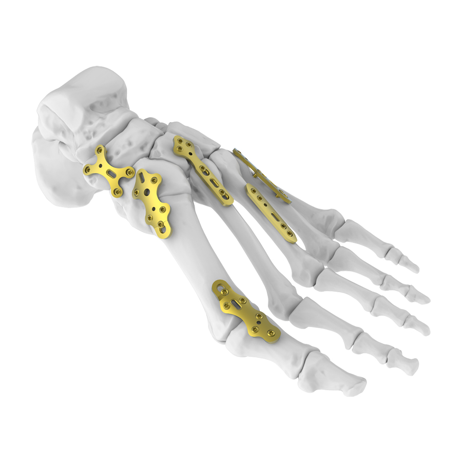 Foot and Ankle