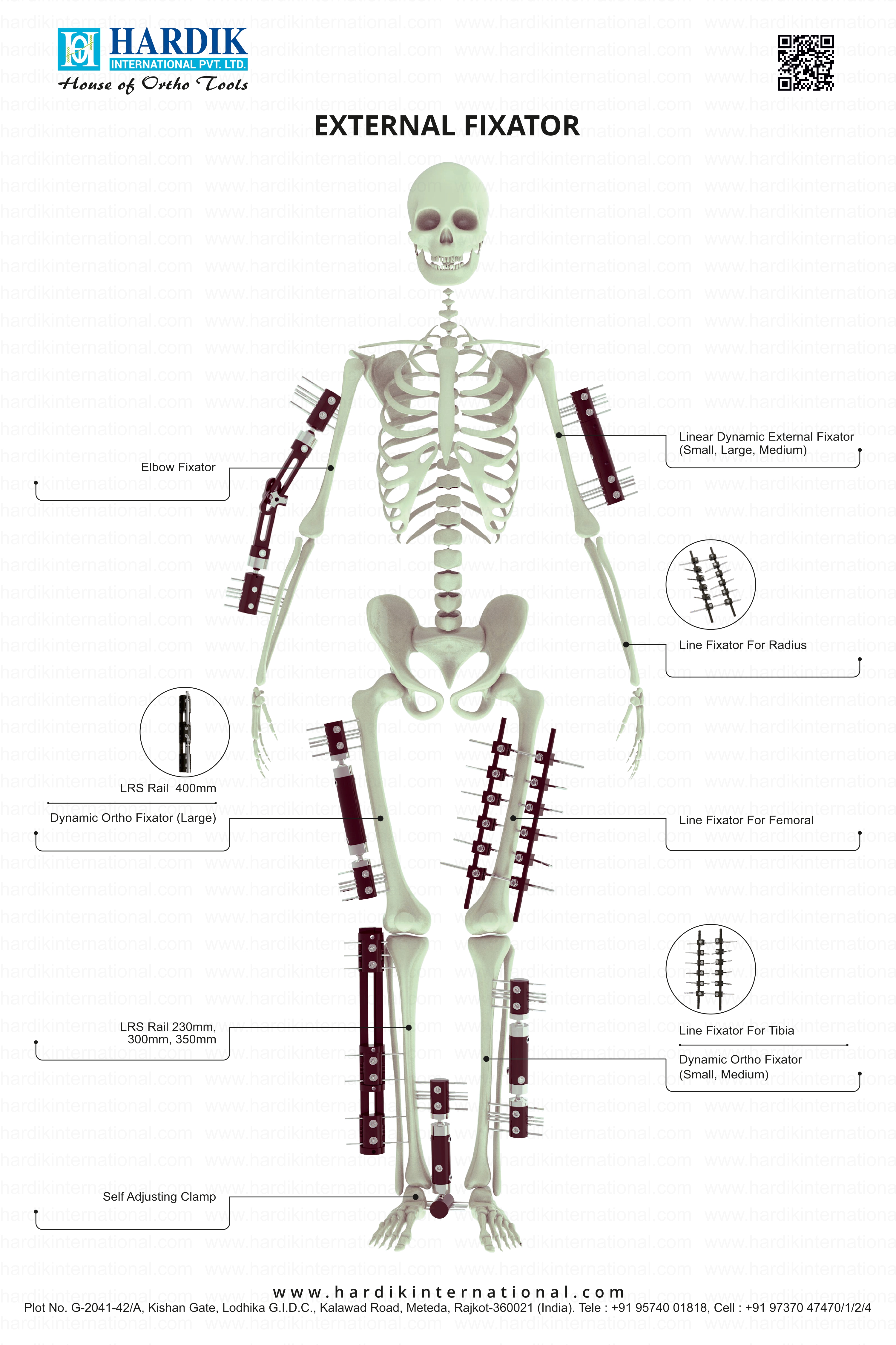 1787568279-3404-external-fixator.jpg