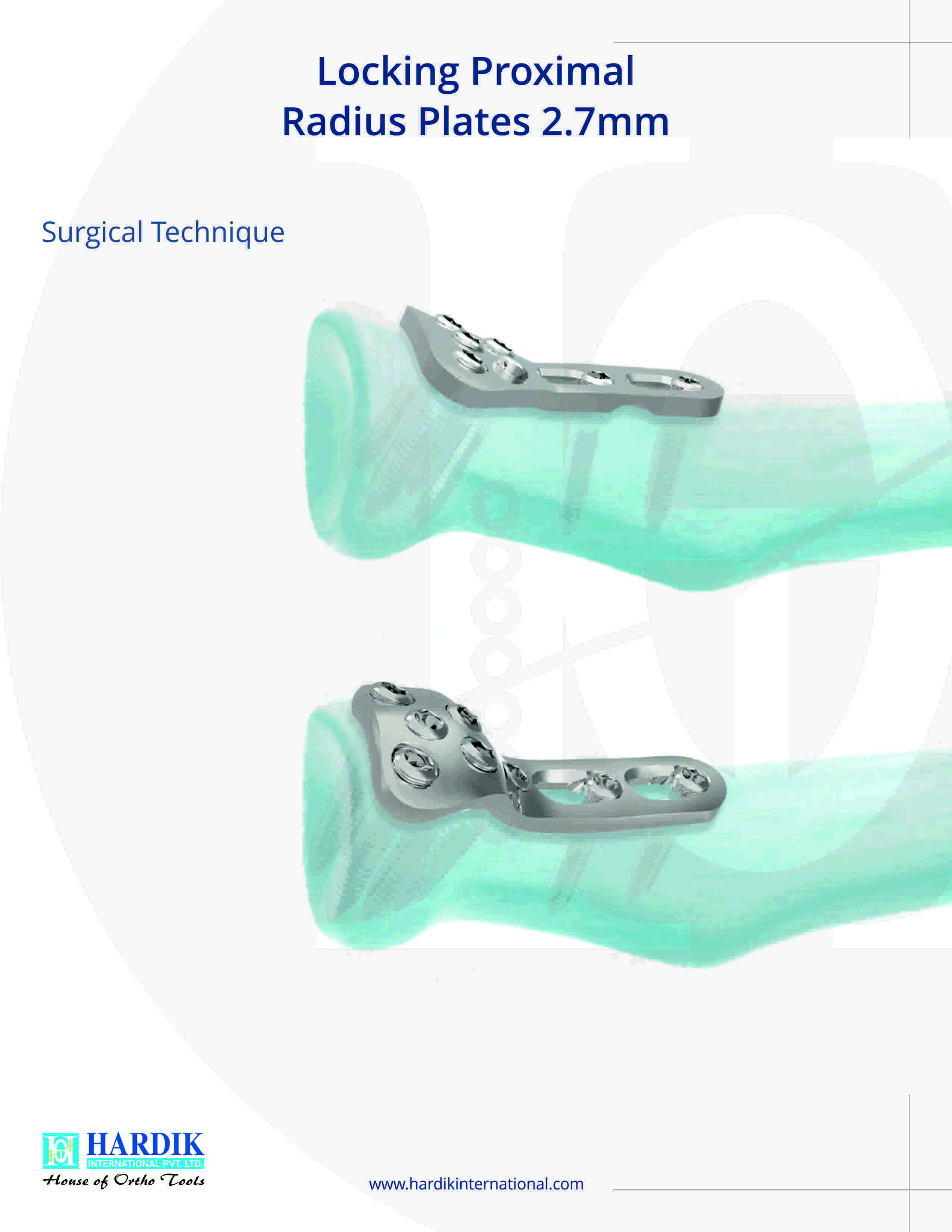 1787568857-1745-locking-proximal-radius-plates-2-7mm.jpg