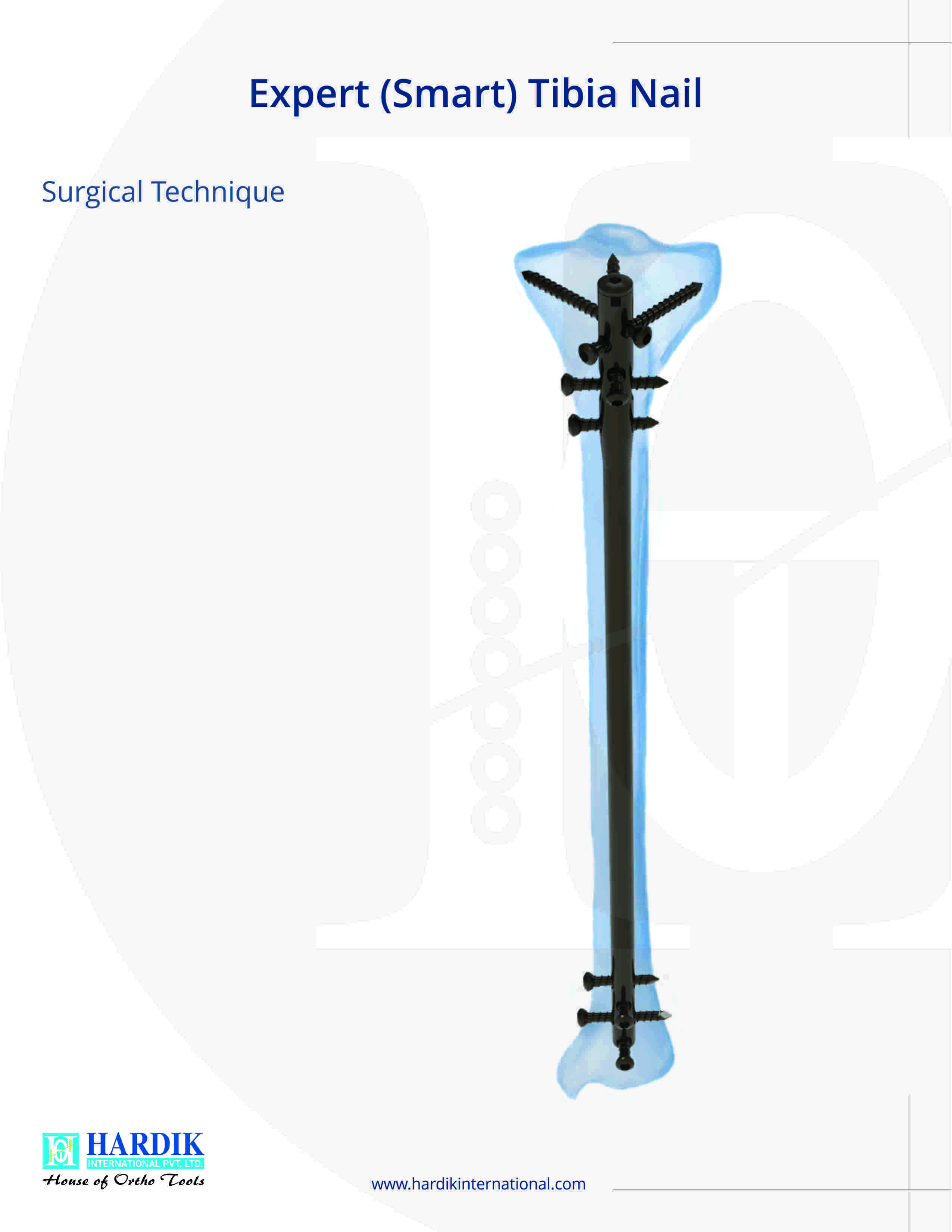 1787569025-3149-expert-tibia-nail.jpg